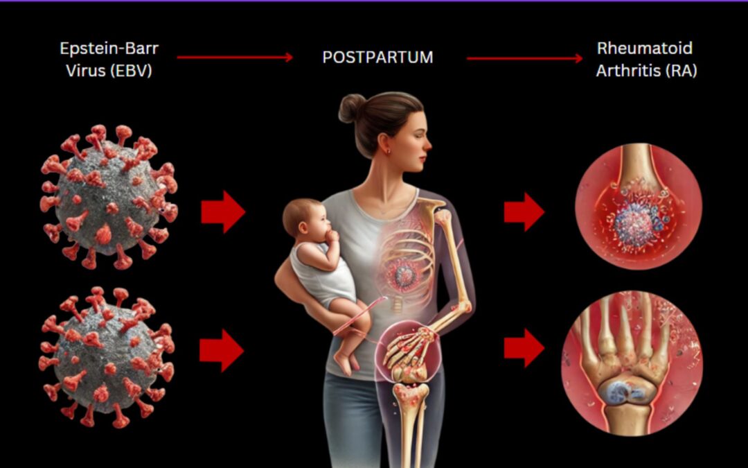 EBV, Postpartum RA, Heavy Metals and Mold