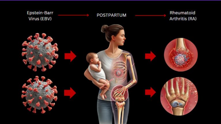EBV, Postpartum RA, Heavy Metals and Mold